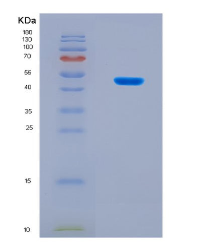 SDS-PAGE analysis of Human FST (Follistatin) - Recombinant Protein, CAT# BLT-08300P, showing >90% purity under 15% SDS-PAGE (Reduced)Human FST (Follistatin) - Recombinant Protein