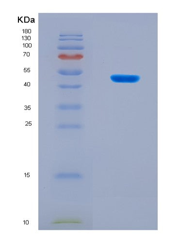 SDS-PAGE analysis of Human FST (Follistatin) - Recombinant Protein, CATHuman FST (Follistatin) - Recombinant Protein