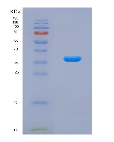 SDS-PAGE analysis of Human COL11A2 (Collagen Alpha-2(Xi) Chain) - Recombinant Protein, CAT# BLT-08301P, showing >90% purity under 15% SDS-PAGE (Reduced)Human COL11A2 (Collagen Alpha-2(Xi) Chain) - Recombinant Protein