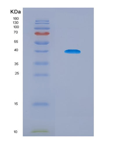 SDS-PAGE analysis of Human EPAS1 (Endothelial Pas Domain-Containing Protein 1) - Recombinant Protein, CAT# BLT-08303P, showing >95% purity under 15% SDS-PAGE (Reduced)Human EPAS1 (Endothelial Pas Domain-Containing Protein 1) - Recombinant Protein