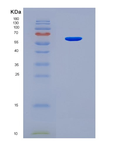 SDS-PAGE analysis of Human SP1 (Transcription Factor Sp1) - Recombinant Protein, CATHuman SP1 (Transcription Factor Sp1) - Recombinant Protein