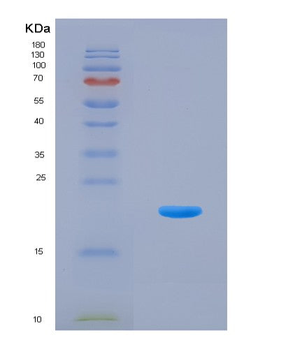 SDS-PAGE analysis of Mouse Slpi (Antileukoproteinase) - Recombinant Protein, CATMouse Slpi (Antileukoproteinase) - Recombinant Protein