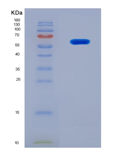 SDS-PAGE analysis of Human SBSN (Suprabasin) - Recombinant Protein, CAT# BLT-08308P, showing >90% purity under 15% SDS-PAGE (Reduced)Human SBSN (Suprabasin) - Recombinant Protein