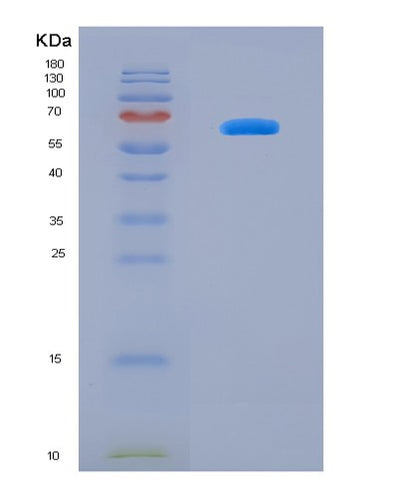 SDS-PAGE analysis of Human DUSP12 (Dual Specificity Protein Phosphatase 12) - Recombinant Protein, CAT# BLT-08310P, showing >90% purity under 15% SDS-PAGE (Reduced)Human DUSP12 (Dual Specificity Protein Phosphatase 12) - Recombinant Protein