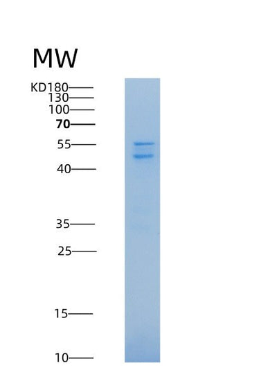 SDS-PAGE analysis of Mouse Calr (Calreticulin) - Recombinant Protein, CAT# BLT-08311P, showing >90% purity under 15% SDS-PAGE (Reduced)Mouse Calr (Calreticulin) - Recombinant Protein