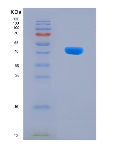 SDS-PAGE analysis of Human PPP1R3G (Protein Phosphatase 1 Regulatory Subunit 3G) - Recombinant Protein, CATHuman PPP1R3G (Protein Phosphatase 1 Regulatory Subunit 3G) - Recombinant Protein