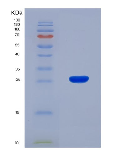 SDS-PAGE analysis of Human ADAMTS9 (A Disintegrin And Metalloproteinase With Thrombospondin Motifs 9) - Recombinant Protein, CAT# BLT-08315P, showing >90% purity under 15% SDS-PAGE (Reduced)Human ADAMTS9 (A Disintegrin And Metalloproteinase With Thrombospondin Motifs 9) - Recombinant Protein