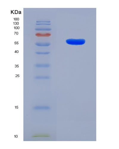 SDS-PAGE analysis of Human VDAC1 (Non-Selective Voltage-Gated Ion Channel Vdac1) - Recombinant Protein, CAT# BLT-08316P, showing >90% purity under 15% SDS-PAGE (Reduced)Human VDAC1 (Non-Selective Voltage-Gated Ion Channel Vdac1) - Recombinant Protein