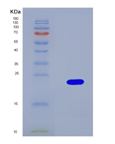SDS-PAGE analysis of Mouse Mettl3 (N(6)-Adenosine-Methyltransferase Catalytic Subunit Mettl3) - Recombinant Protein, CATMouse Mettl3 (N(6)-Adenosine-Methyltransferase Catalytic Subunit Mettl3) - Recombinant Protein