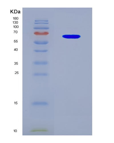 SDS-PAGE analysis of Human KMT5C (Histone-Lysine N-Methyltransferase Kmt5C) - Recombinant Protein, CAT# BLT-08318P, showing >90% purity under 15% SDS-PAGE (Reduced)Human KMT5C (Histone-Lysine N-Methyltransferase Kmt5C) - Recombinant Protein