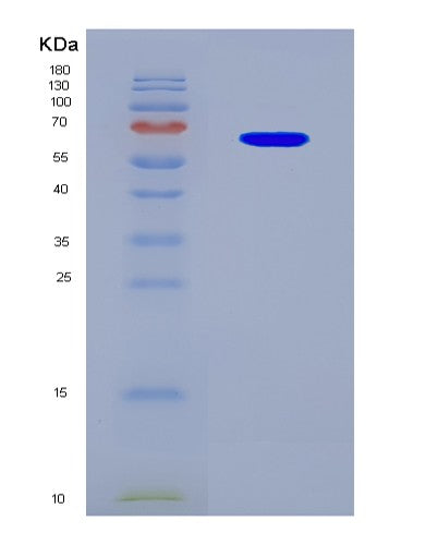 SDS-PAGE analysis of Human KMT5C (Histone-Lysine N-Methyltransferase Kmt5C) - Recombinant Protein, CATHuman KMT5C (Histone-Lysine N-Methyltransferase Kmt5C) - Recombinant Protein