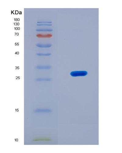 SDS-PAGE analysis of Human TOP2B (Dna Topoisomerase 2-Beta) - Recombinant Protein, CAT# BLT-08320P, showing >90% purity under 15% SDS-PAGE (Reduced)Human TOP2B (Dna Topoisomerase 2-Beta) - Recombinant Protein