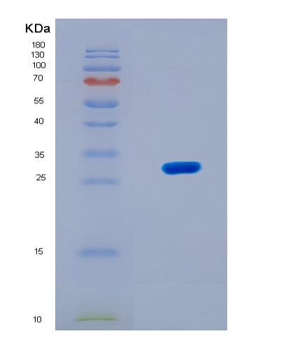 SDS-PAGE analysis of Human TOP2B (Dna Topoisomerase 2-Beta) - Recombinant Protein, CATHuman TOP2B (Dna Topoisomerase 2-Beta) - Recombinant Protein