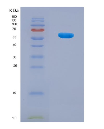 SDS-PAGE analysis of Human NDUFV1 (Nadh Dehydrogenase [Ubiquinone] Flavoprotein 1, Mitochondrial) - Recombinant Protein, CAT# BLT-08321P, showing >90% purity under 15% SDS-PAGE (Reduced)Human NDUFV1 (Nadh Dehydrogenase [Ubiquinone] Flavoprotein 1, Mitochondrial) - Recombinant Protein