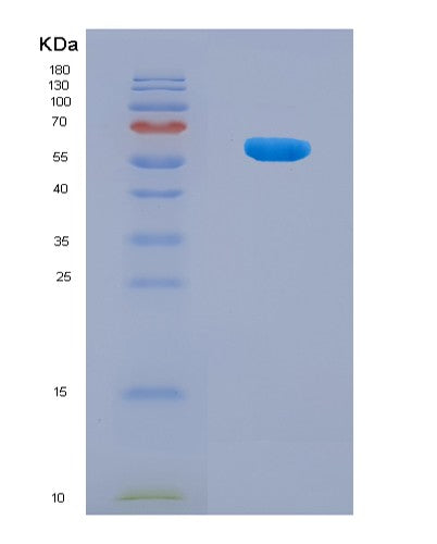 SDS-PAGE analysis of Human NDUFV1 (Nadh Dehydrogenase [Ubiquinone] Flavoprotein 1, Mitochondrial) - Recombinant Protein, CATHuman NDUFV1 (Nadh Dehydrogenase [Ubiquinone] Flavoprotein 1, Mitochondrial) - Recombinant Protein