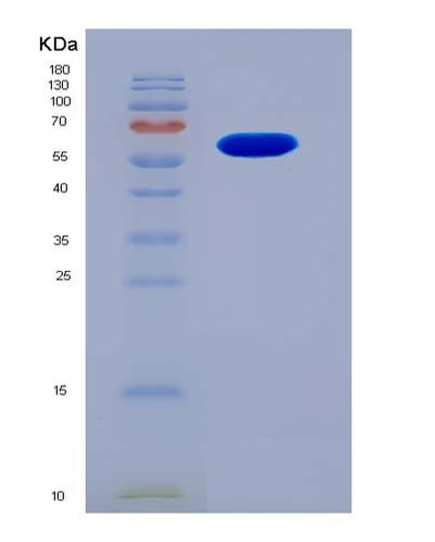 SDS-PAGE analysis of Human KIN (Dna/Rna-Binding Protein Kin17) - Recombinant Protein, CAT# BLT-01625P, showing >95% purity under 15% SDS-PAGE (Reduced)Human KIN (Dna/Rna-Binding Protein Kin17) - Recombinant Protein
