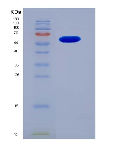 SDS-PAGE analysis of Human KIN (Dna/Rna-Binding Protein Kin17) - Recombinant Protein, CATHuman KIN (Dna/Rna-Binding Protein Kin17) - Recombinant Protein