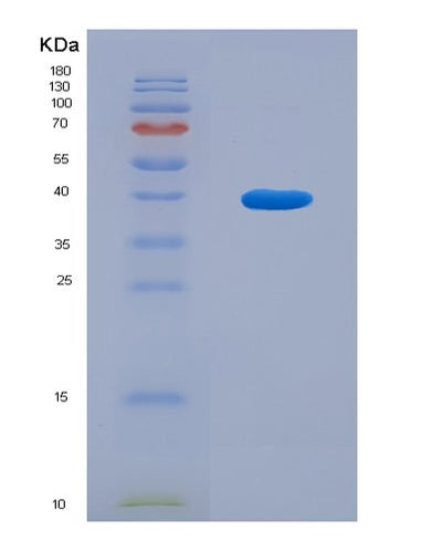 SDS-PAGE analysis of Human GOLPH3 (Golgi Phosphoprotein 3) - Recombinant Protein, CAT# BLT-08325P, showing >90% purity under 15% SDS-PAGE (Reduced)Human GOLPH3 (Golgi Phosphoprotein 3) - Recombinant Protein