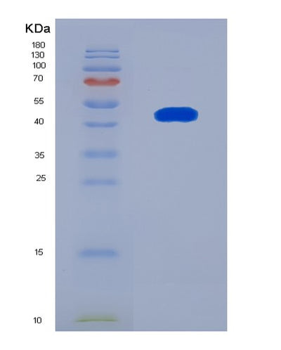 SDS-PAGE analysis of Human STOM (Stomatin) - Recombinant Protein, CAT# BLT-08326P, showing >90% purity under 15% SDS-PAGE (Reduced)Human STOM (Stomatin) - Recombinant Protein