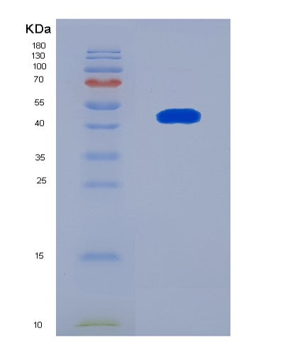 SDS-PAGE analysis of Human STOM (Stomatin) - Recombinant Protein, CATHuman STOM (Stomatin) - Recombinant Protein