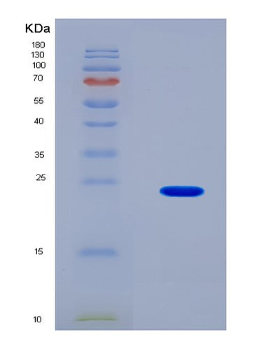 SDS-PAGE analysis of Human IGF1 (Insulin-Like Growth Factor 1) - Recombinant Protein, CAT# BLT-08328P, showing >90% purity under 15% SDS-PAGE (Reduced)Human IGF1 (Insulin-Like Growth Factor 1) - Recombinant Protein