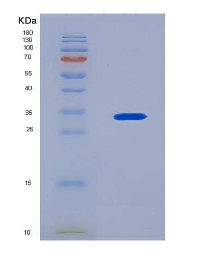 SDS-PAGE analysis of Human MATK (Megakaryocyte-Associated Tyrosine-Protein Kinase) - Recombinant Protein, CAT# BLT-08330P, showing >90% purity under 15% SDS-PAGE (Reduced)Human MATK (Megakaryocyte-Associated Tyrosine-Protein Kinase) - Recombinant Protein