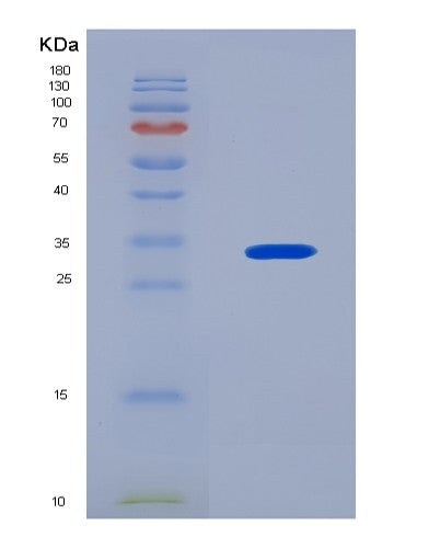 SDS-PAGE analysis of Human MATK (Megakaryocyte-Associated Tyrosine-Protein Kinase) - Recombinant Protein, CATHuman MATK (Megakaryocyte-Associated Tyrosine-Protein Kinase) - Recombinant Protein