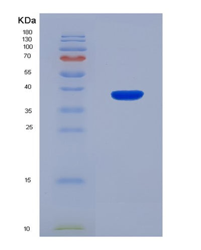 SDS-PAGE analysis of Mouse Matk (Megakaryocyte-Associated Tyrosine-Protein Kinase) - Recombinant Protein, CAT# BLT-08331P, showing >90% purity under 15% SDS-PAGE (Reduced)Mouse Matk (Megakaryocyte-Associated Tyrosine-Protein Kinase) - Recombinant Protein