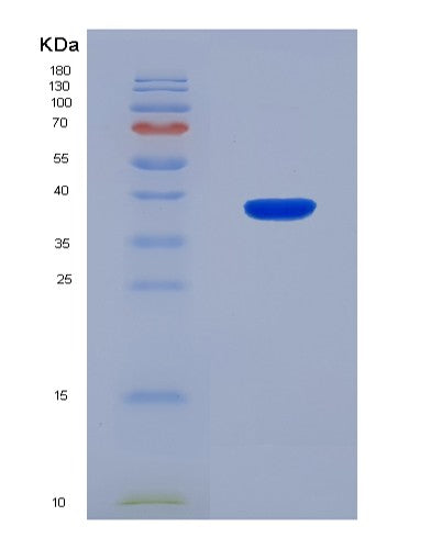 SDS-PAGE analysis of Mouse Matk (Megakaryocyte-Associated Tyrosine-Protein Kinase) - Recombinant Protein, CATMouse Matk (Megakaryocyte-Associated Tyrosine-Protein Kinase) - Recombinant Protein