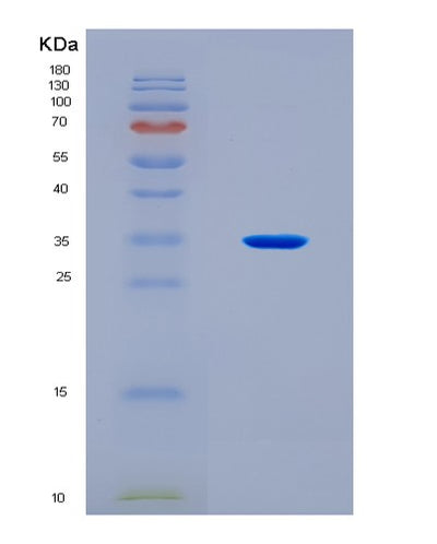 SDS-PAGE analysis of Human SYCP3 (Synaptonemal Complex Protein 3) - Recombinant Protein, CAT# BLT-08334P, showing >90% purity under 15% SDS-PAGE (Reduced)Human SYCP3 (Synaptonemal Complex Protein 3) - Recombinant Protein