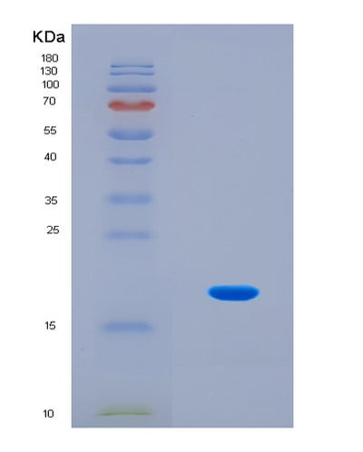 SDS-PAGE analysis of Mouse Rplp2 (Large Ribosomal Subunit Protein P2) - Recombinant Protein, CAT# BLT-08470P showing >90% purity under 15% SDS-PAGE (Reduced)Mouse Rplp2 (Large Ribosomal Subunit Protein P2) - Recombinant Protein