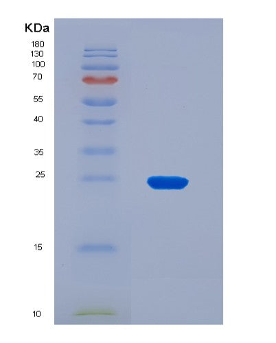 SDS-PAGE analysis of Mouse Iscu (Iron-Sulfur Cluster Assembly Enzyme Iscu) - Recombinant Protein, CATMouse Iscu (Iron-Sulfur Cluster Assembly Enzyme Iscu) - Recombinant Protein