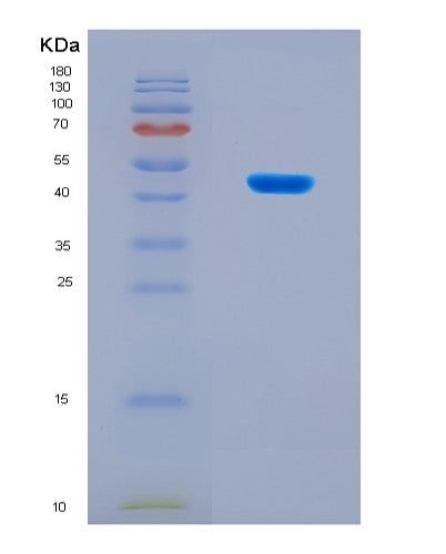 SDS-PAGE analysis of Mouse Ppara (Peroxisome Proliferator-Activated Receptor Alpha) - Recombinant Protein, CATMouse Ppara (Peroxisome Proliferator-Activated Receptor Alpha) - Recombinant Protein