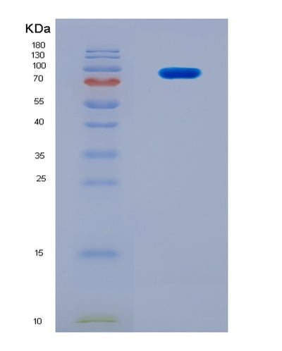 SDS-PAGE analysis of Human SYK (Tyrosine-Protein Kinase Syk) - Recombinant Protein, CAT# BLT-08340P, showing >90% purity under 15% SDS-PAGE (Reduced)Human SYK (Tyrosine-Protein Kinase Syk) - Recombinant Protein