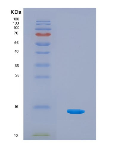 SDS-PAGE analysis of Human SNCA (Alpha-Synuclein) - Recombinant Protein, CAT# BLT-08341P, showing >90% purity under 15% SDS-PAGE (Reduced)Human SNCA (Alpha-Synuclein) - Recombinant Protein
