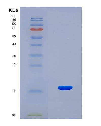 SDS-PAGE analysis of Human INHBE (Inhibin Beta E Chain) - Recombinant Protein, CAT# BLT-08342P, showing >90% purity under 15% SDS-PAGE (Reduced)Human INHBE (Inhibin Beta E Chain) - Recombinant Protein