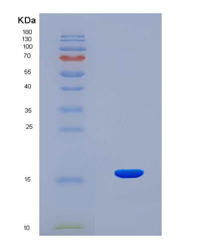 SDS-PAGE analysis of Human INHBE (Inhibin Beta E Chain) - Recombinant Protein, CATHuman INHBE (Inhibin Beta E Chain) - Recombinant Protein
