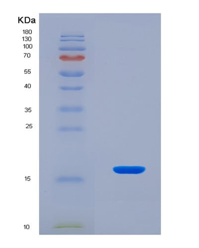 SDS-PAGE analysis of Human Inhibin Beta E (INHbE) - Recombinant Protein, CAT# BLT-08343P, showing >90% purity under 15% SDS-PAGE (Reduced)Human Inhibin Beta E (INHbE) - Recombinant Protein