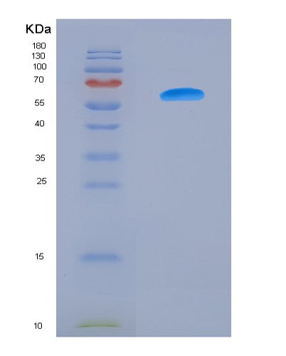 SDS-PAGE analysis of Human MMP2 (72 Kda Type Iv Collagenase) - Recombinant Protein, CATHuman MMP2 (72 Kda Type Iv Collagenase) - Recombinant Protein