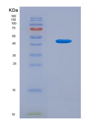 SDS-PAGE analysis of Mouse Mgst1 (Microsomal Glutathione S-Transferase 1) - Recombinant Protein, CAT# BLT-08347P, showing >90% purity under 15% SDS-PAGE (Reduced)Mouse Mgst1 (Microsomal Glutathione S-Transferase 1) - Recombinant Protein