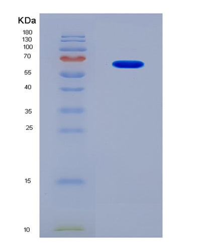 SDS-PAGE analysis of Human CCNE2 (G1/S-Specific Cyclin-E2) - Recombinant Protein, CAT# BLT-08348P, showing >90% purity under 15% SDS-PAGE (Reduced)Human CCNE2 (G1/S-Specific Cyclin-E2) - Recombinant Protein