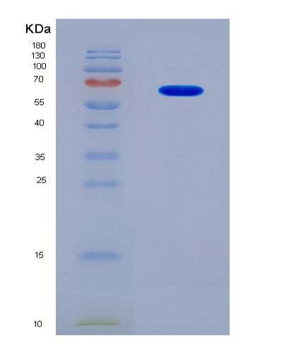 SDS-PAGE analysis of Human CCNE2 (G1/S-Specific Cyclin-E2) - Recombinant Protein, CATHuman CCNE2 (G1/S-Specific Cyclin-E2) - Recombinant Protein