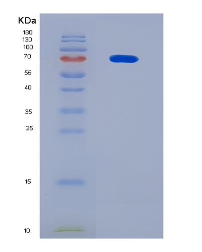 SDS-PAGE analysis of Human METTL3 (N(6)-Adenosine-Methyltransferase Catalytic Subunit Mettl3) - Recombinant Protein, CAT# BLT-08350P, showing >90% purity under 15% SDS-PAGE (Reduced)Human METTL3 (N(6)-Adenosine-Methyltransferase Catalytic Subunit Mettl3) - Recombinant Protein