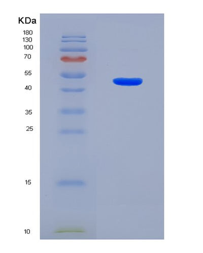 SDS-PAGE analysis of Human CDK8 (Cyclin-Dependent Kinase 8) - Recombinant Protein, CAT# BLT-08353P, showing >90% purity under 15% SDS-PAGE (Reduced)Human CDK8 (Cyclin-Dependent Kinase 8) - Recombinant Protein