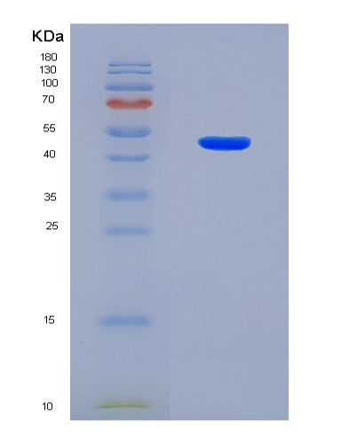 SDS-PAGE analysis of Human CDK8 (Cyclin-Dependent Kinase 8) - Recombinant Protein, CATHuman CDK8 (Cyclin-Dependent Kinase 8) - Recombinant Protein