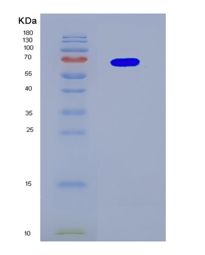 SDS-PAGE analysis of Human MAP2K1 (Dual Specificity Mitogen-Activated Protein Kinase Kinase 1) - Recombinant Protein, CAT# BLT-08356P, showing >90% purity under 15% SDS-PAGE (Reduced)Human MAP2K1 (Dual Specificity Mitogen-Activated Protein Kinase Kinase 1) - Recombinant Protein