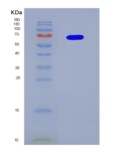 SDS-PAGE analysis of Human MAP2K1 (Dual Specificity Mitogen-Activated Protein Kinase Kinase 1) - Recombinant Protein, CATHuman MAP2K1 (Dual Specificity Mitogen-Activated Protein Kinase Kinase 1) - Recombinant Protein