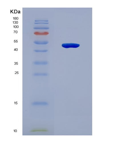 SDS-PAGE analysis of Human CDCA8 (Borealin) - Recombinant Protein, CAT# BLT-08358P, showing >90% purity under 15% SDS-PAGE (Reduced)Human CDCA8 (Borealin) - Recombinant Protein
