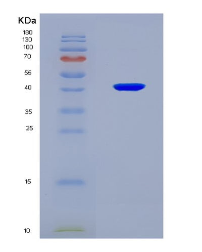 SDS-PAGE analysis of Human RAD51 (Dna Repair Protein Rad51 Homolog 1) - Recombinant Protein, CAT# BLT-08359P, showing >90% purity under 15% SDS-PAGE (Reduced)Human RAD51 (Dna Repair Protein Rad51 Homolog 1) - Recombinant Protein