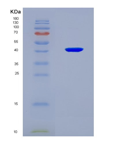 SDS-PAGE analysis of Human RAD51 (Dna Repair Protein Rad51 Homolog 1) - Recombinant Protein, CATHuman RAD51 (Dna Repair Protein Rad51 Homolog 1) - Recombinant Protein